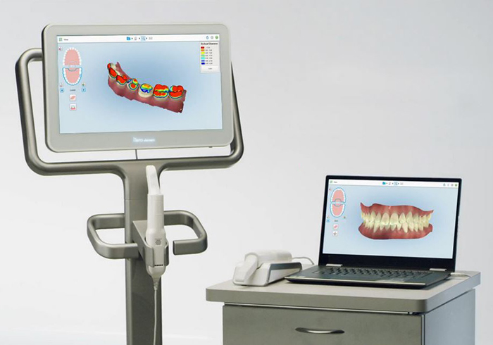 光学式3Dスキャナー（iTero）で矯正後の歯並びシミュレーションが可能です
