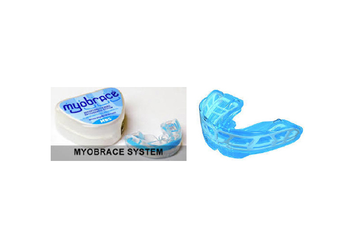 歯列矯正用咬合誘導装置～マイオブレース<Myobrace>（※3）～