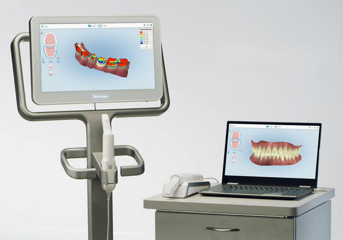 特徴3：おとなの矯正にももちろん対応します～口腔内スキャナー（iTero）を導入～